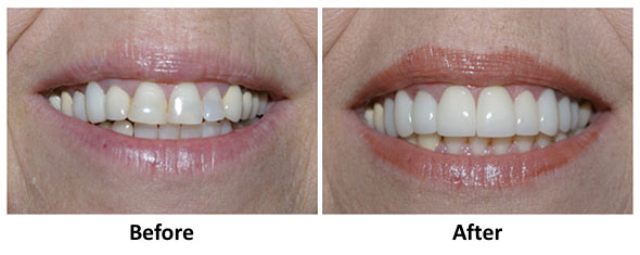 cosmetic dentistry lancaster pa